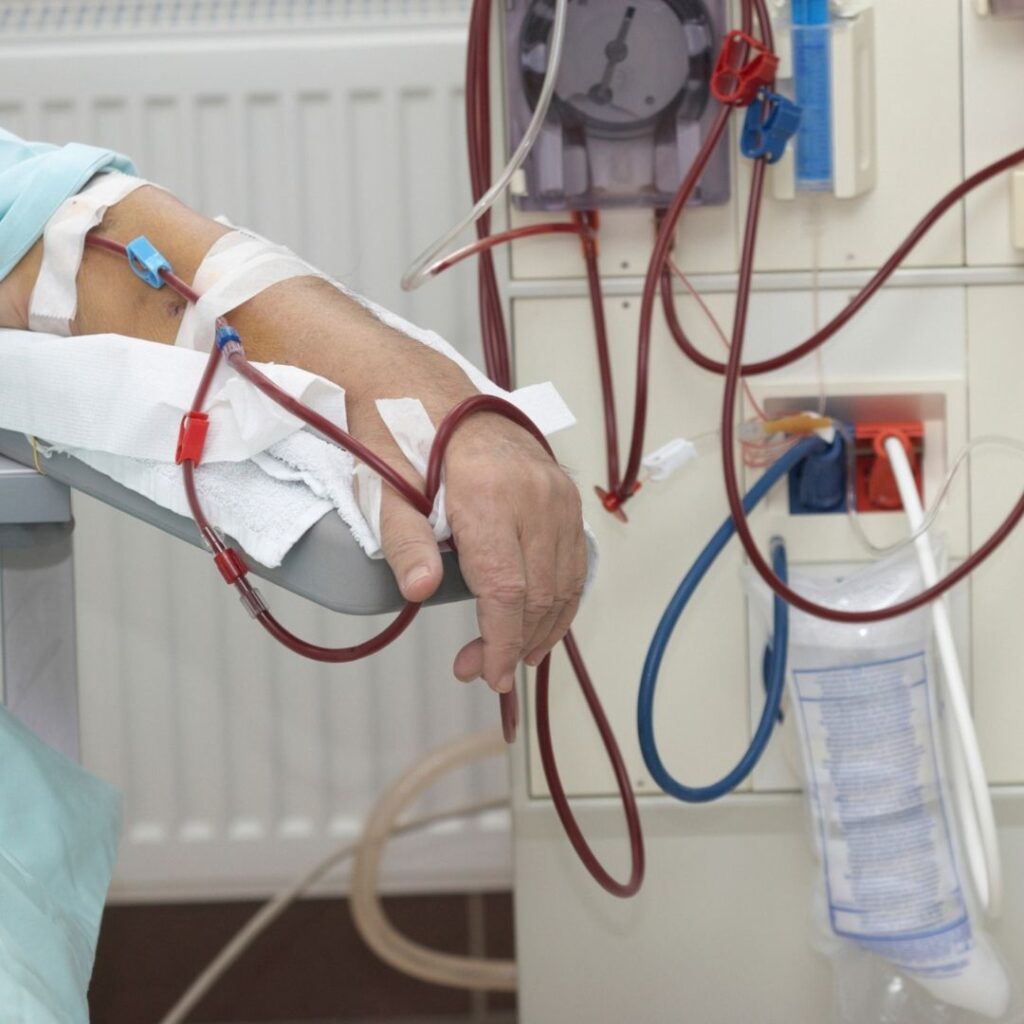 person hooked up to dialysis machine